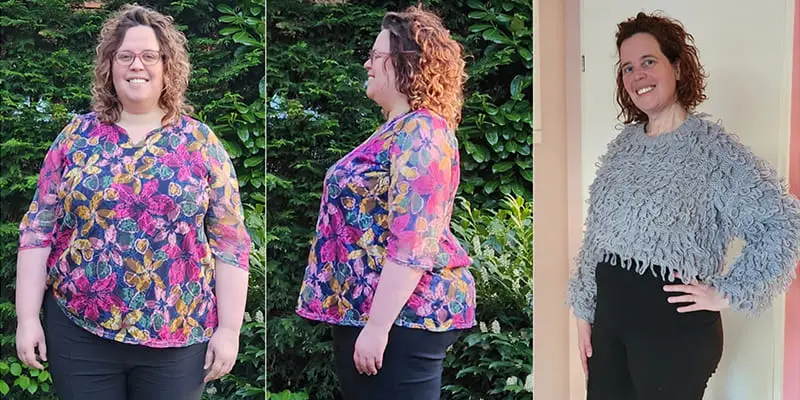 Gastric Bypass - Voor & Na - Ingrid van Eekeren