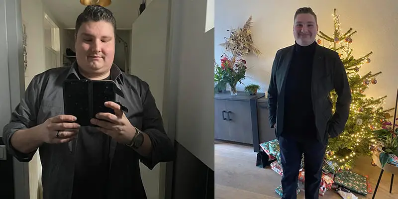 Gastric Bypass - Voor & Na - Meneer Jansen