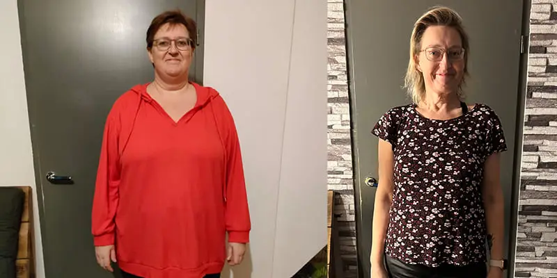 Gastric Bypass - Voor en na - Saskia Holtrop