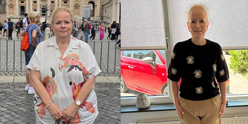 Maagverkleining ervaring - Jolanda