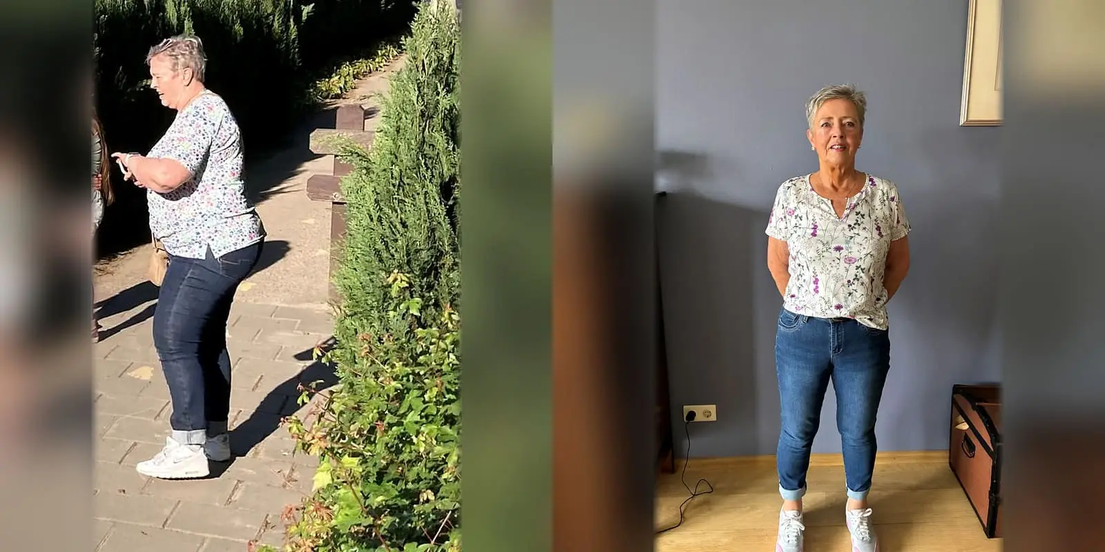 Maagverkleining ervaring - Foto voor en na van Loor